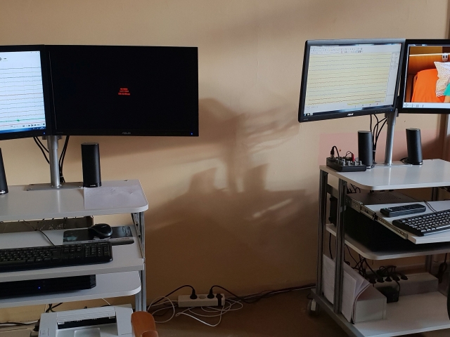 Video EEG telemetrija 1